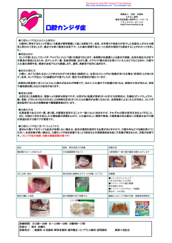 口腔カンジダ症 - たかなし歯科