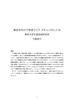 CT スキャン - SNG