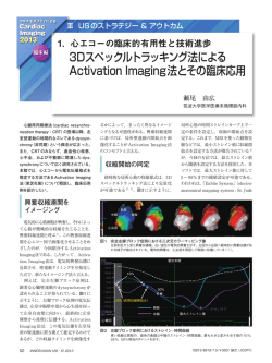 3Dスペックルトラッキング法による Activation Imaging法とその臨床応用