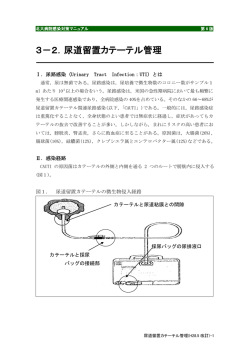 3－2．尿道留置カテーテル管理