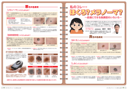 Page 1 悪性の色素斑 「メラノーマ」ってどんなもの