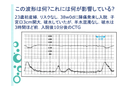この波形は何?これには何が影響している?