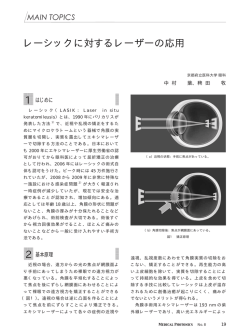 レーシックに対するレーザーの応用 1 2