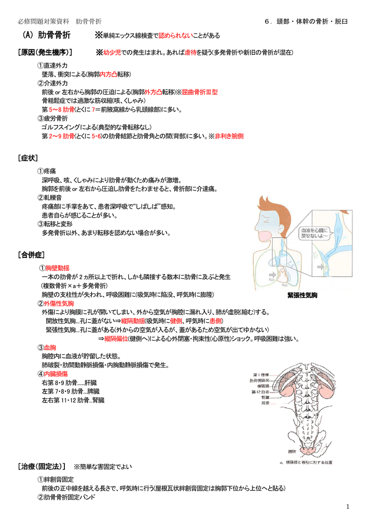 A 肋骨骨折