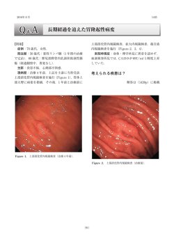 長期経過を追えた胃隆起性病変