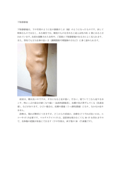 静脈瘤を指摘された