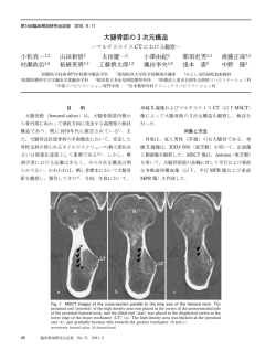 大腿骨距の  次元構造