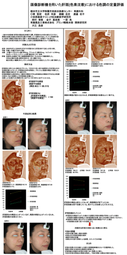 画像診断機を用いた肝斑(色素沈着)における色調の定量評価