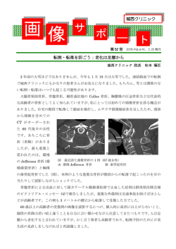 第52号