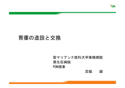 胃瘻の造設と交換