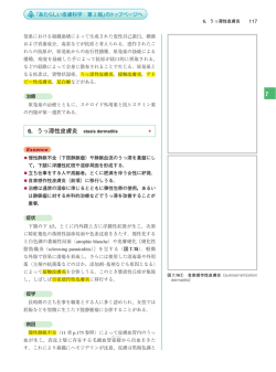 6．うっ滞性皮膚炎﻿ stasis dermatitis