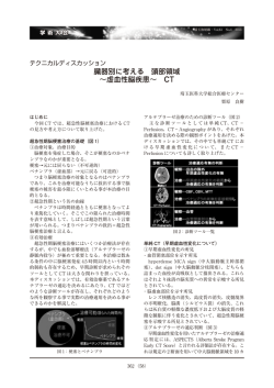 臓器別に考える 頭部領域 〜虚血性脳疾患〜 CT