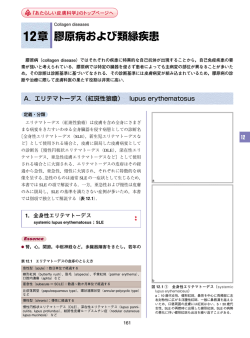 紅斑性狼瘡