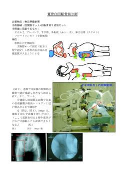 Dial骨切り術手順