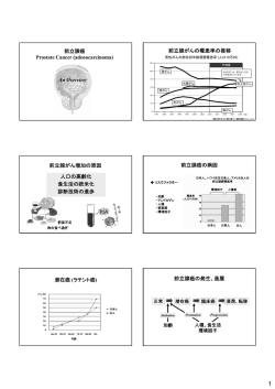 前立腺癌 Prostate Cancer (adenocarcinoma) An Overview 前立腺が