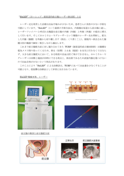 “HoLEP”（ホーレップ：経尿道的前立腺レーザー核出術）とは レーザー光を