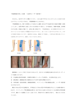 下肢静脈瘤の新しい治療 〜血管内レーザー焼灼術〜 みなさん、足が