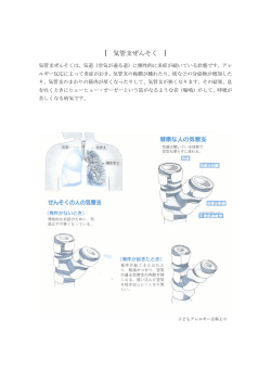 気管支喘息の説明