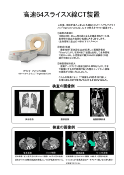 高速64スライスX線CT装置