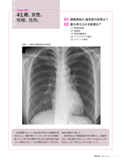 41歳、女性。 咳嗽、発熱。