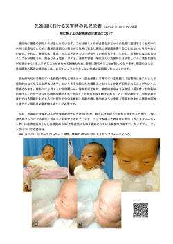 災害時の乳児栄養 特に粉ミルク配布時の注意点について