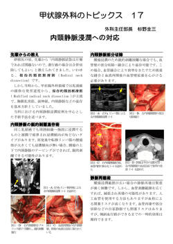 内頸静脈浸潤への対応