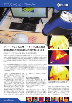アプリケーション ストーリー - アズビルトレーディング株式会社
