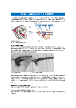 特集： JARMeC のコイル塞栓術
