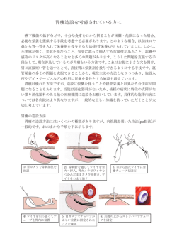 胃瘻造設を考慮されている方に