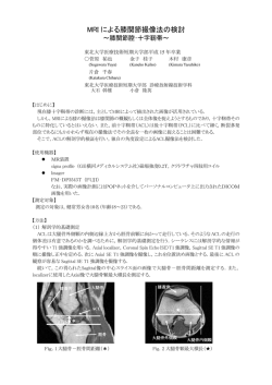 MRI による膝関節撮像法の検討