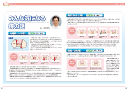 みんな気になる 痔の話