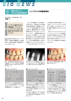 インプラントの印象採得法