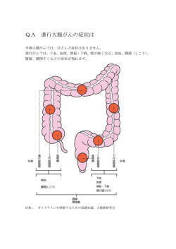 QA 進行大腸がんの症状は