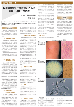 皮膚真菌症：白癬を中心として &minus;診断・治療・予防法