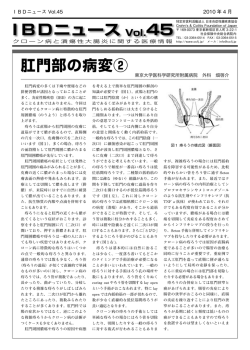 肛門部の病変② IBDニュース
