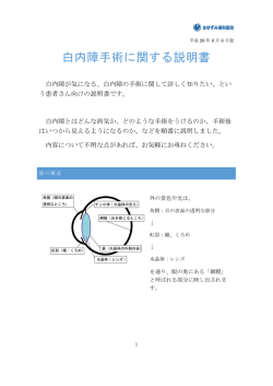 白内障手術に関する説明書