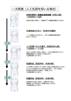 一次再建（人工乳房を用いる場合）