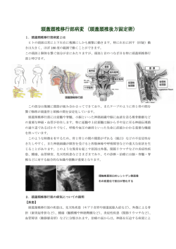 1．頭蓋頸椎移行部病変とは ヒトの頭部は常に上下左右に複雑にしかも