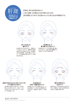 肝斑は、特にほほ骨のあたり - 第一三共ヘルスケア株式会社