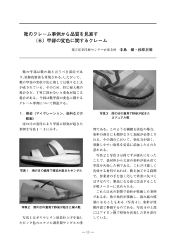 靴のクレーム事例から品質を見直す