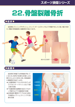 22.骨盤裂離骨折 - 日本整形外科スポーツ医学会