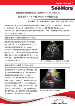 SeeMore Info - USB超音波診断 SeeMore(シーモア)｜超音波診断装置