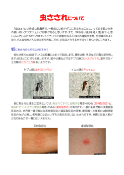 虫さされについて