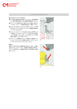 レジンボンディングテクニック