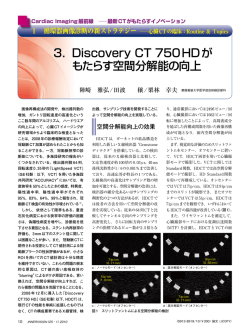 3． Discovery CT 750HDが もたらす空間分解能の向上