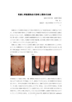 乾癬と掌蹠膿胞症の診断と最新の治療