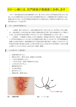 16.クローン病には、肛門病変が高頻度に合併します