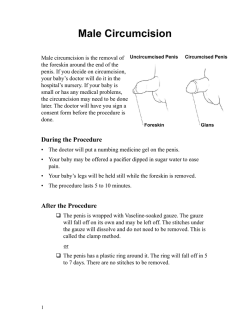 Male Circumcision - Japanese - Health Information Translations