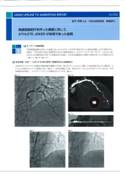 高度屈曲蛇行を伴った病変に対して、 ATHLETE J。KER が有用であった