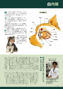 白内障
